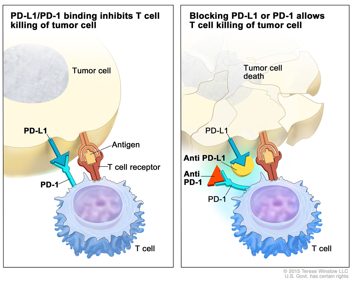 Figure 1 – Atezolizumab blocks the binding on PD-1 receptor on T-cells with PD-L1 ligand on antigen presenting cells, including tumor cells. https://www.cancer.gov/news-events/cancer-currents-blog/2016/fda-atezolizumab-bladder