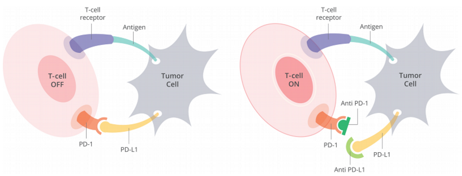 Figure 1. Cells have a protein on their surface called PD-1 (in orange above). When PD-1 binds to PD-L1 (yellow) on another cell, the T cell becomes deactivated. Most cancer cells have PD-L1 on their surface and escape being killed by turning off the T cell in this way. Anti-PD-1 antibodies (dark green) or anti-PD-L1 antibodies (light green) can prevent the tumor cell from binding PD-1 and thus allow T cells to remain active. http://www.curetoday.com/articles/fda-approves-frontline-opdivo-for-braf-mutant-melanoma