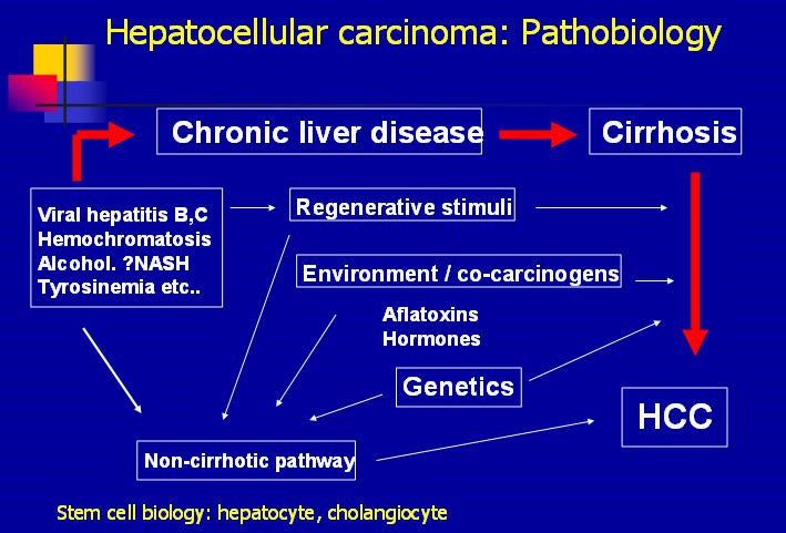 Pathophysiology Of Hepatocellular Carcinoma Download