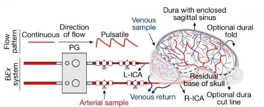 Figure of porcine brain connected to perfusion system