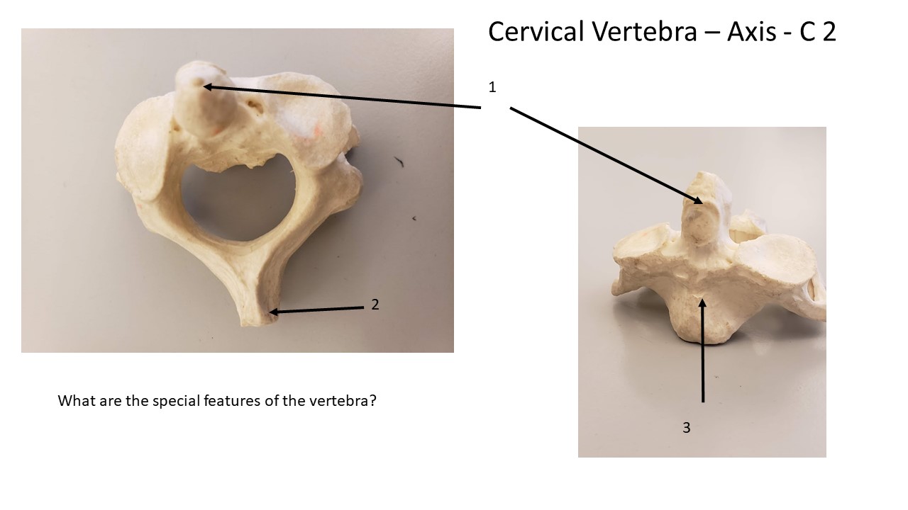 axial skeleton vertebrae