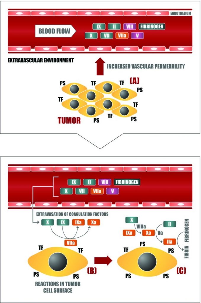 How cancer induces a hypercoagulable state | Cancer Biology