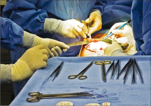 Living Organ Transplantation Policy Transition in Asia: Towards Adaptive Policy Changes