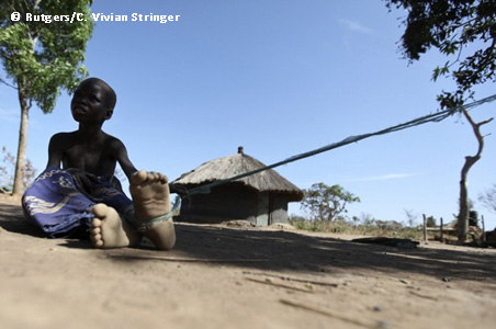 Nodding Syndrome in Post Conflict Northern Uganda: A Human Security Perspective